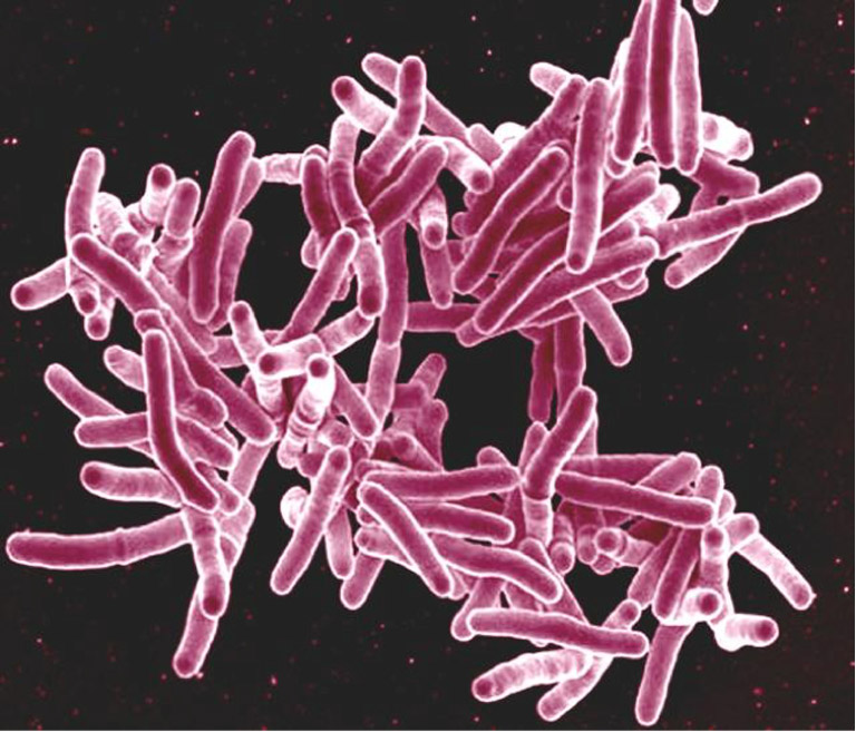 Mycobacteriium tuberculosis bacteria, the cause of TB, susceptible to teixobactin’s unique killing method. Photo credit: NIAID Flickr Creative Commons.