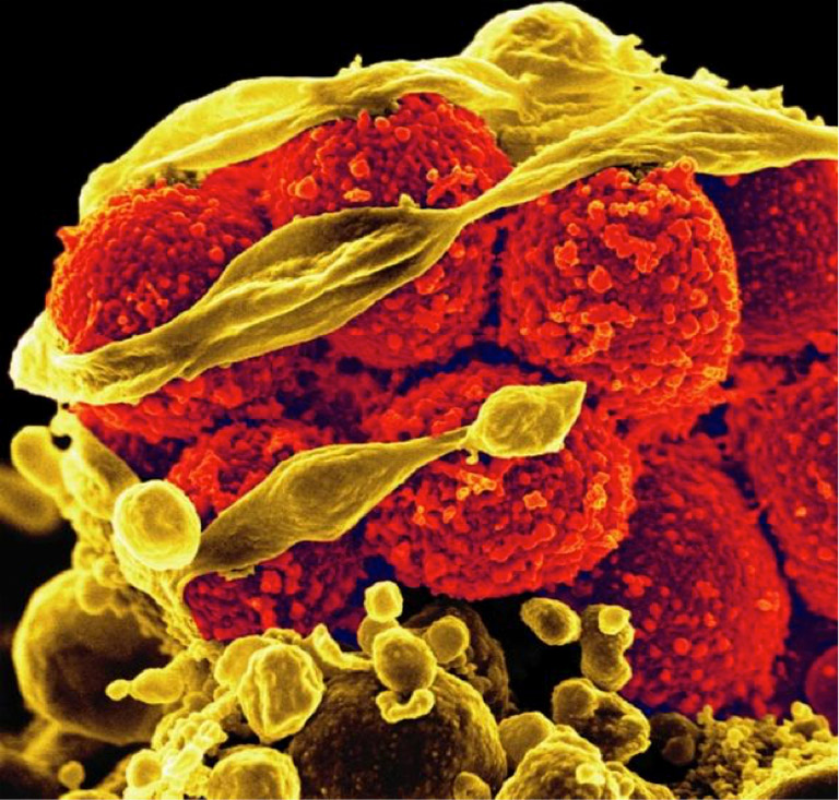 Scanning electron micrograph of MRSA (yellow, round items) killing and escaping from a human white cell. Teixobactin shows effectiveness in killing the pathogen. Photo credit: NIAID Flickr Creative Commons License.
