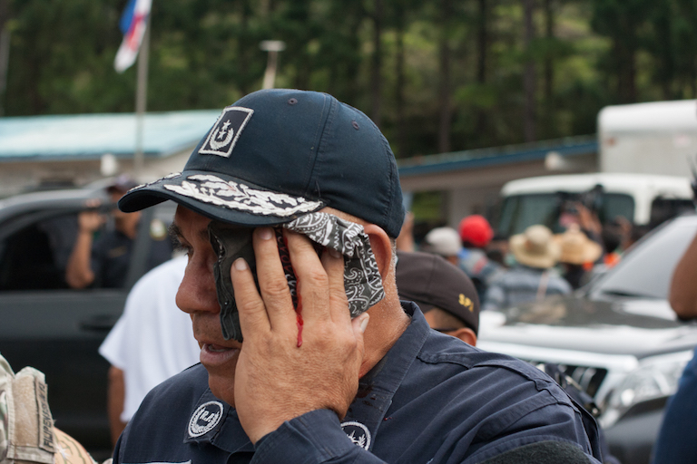 A policeman who was struck on the head with a rock thrown by a protester. Photo by Camilo Mejia Giraldo